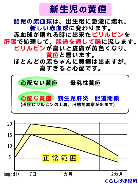 黄疸 看護 新生児